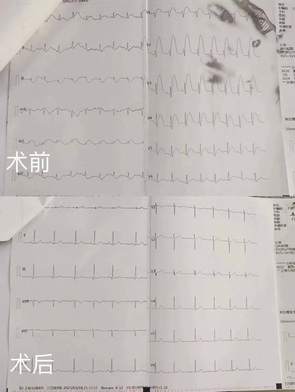 https://mmbiz.qpic.cn/mmbiz_jpg/OMoZ71ahOUBLhkDic2VnBAGJkofyNdB6UNzTibqtdia4pu712EhPgmk2j9K1mCyreo5YemFddicSUJELdLUDcUqwPA/640?wx_fmt=jpeg&wxfrom=5&wx_lazy=1&wx_co=1