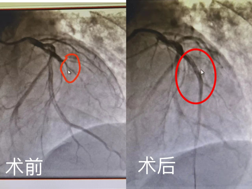 https://mmbiz.qpic.cn/mmbiz_png/OMoZ71ahOUCL65AJaanzicFJmEaDIV7vElRibaicWpH0LK6BpGlsoP50p54dUUicaKu9OlwaeicnwzIjXwWJgJyj8HQ/640?wx_fmt=png&wxfrom=5&wx_lazy=1&wx_co=1