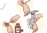 【急診第一線】武寧縣人民醫(yī)院急診科成功救治一名毒蛇咬傷患者